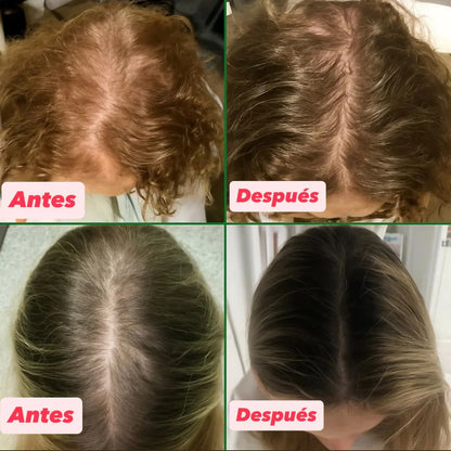 Pack Capilar Batana – Detén la Caída y Activa el Crecimiento Natural en 7 dias